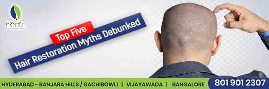 Five-Top-Hair-Restoration-Myths-Debunked-min