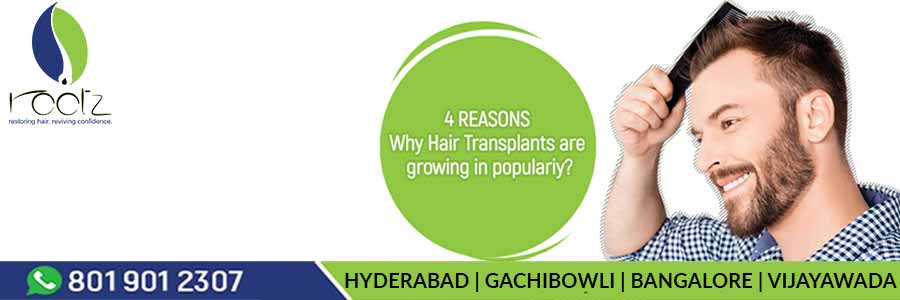 four-reasons-why-hair-transplants-are-growing-in-popularity