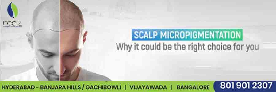 Scalp-Micro-Pigmentation---Why-It-Could-Be-the-Right-Choice-for-You-min